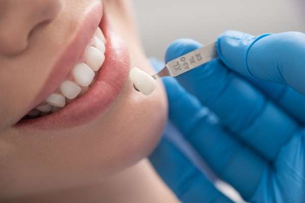 How Dental Crowns Are Used In General Dentistry